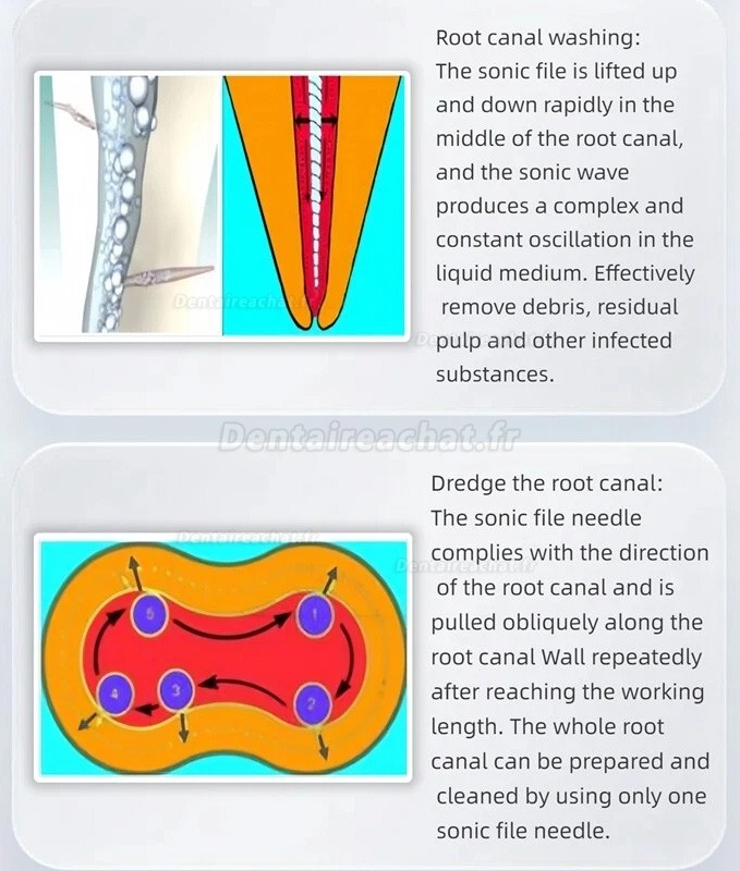 Pièce à main sonic endo activator, pneumatique endoactivator dentaire avec 2 aiguilles à limer